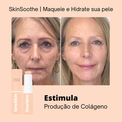 SkinSoothe - Hydrating Moisturizer