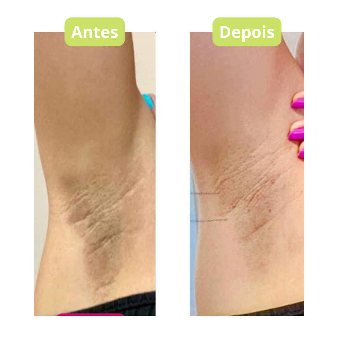 Flawless Skin Brightening Cream