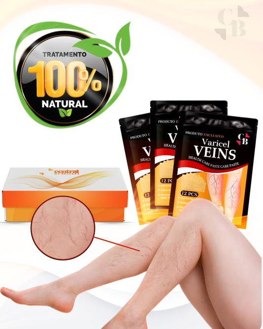 VARICEL - All-Natural Solution for Varicose Veins