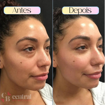 DermaGlow - Dark Circle Eliminator