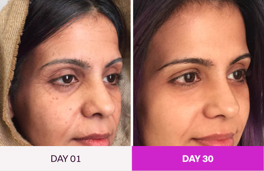 SkinLift - Facial Renewal