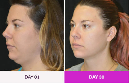 SkinLift - Facial Renewal